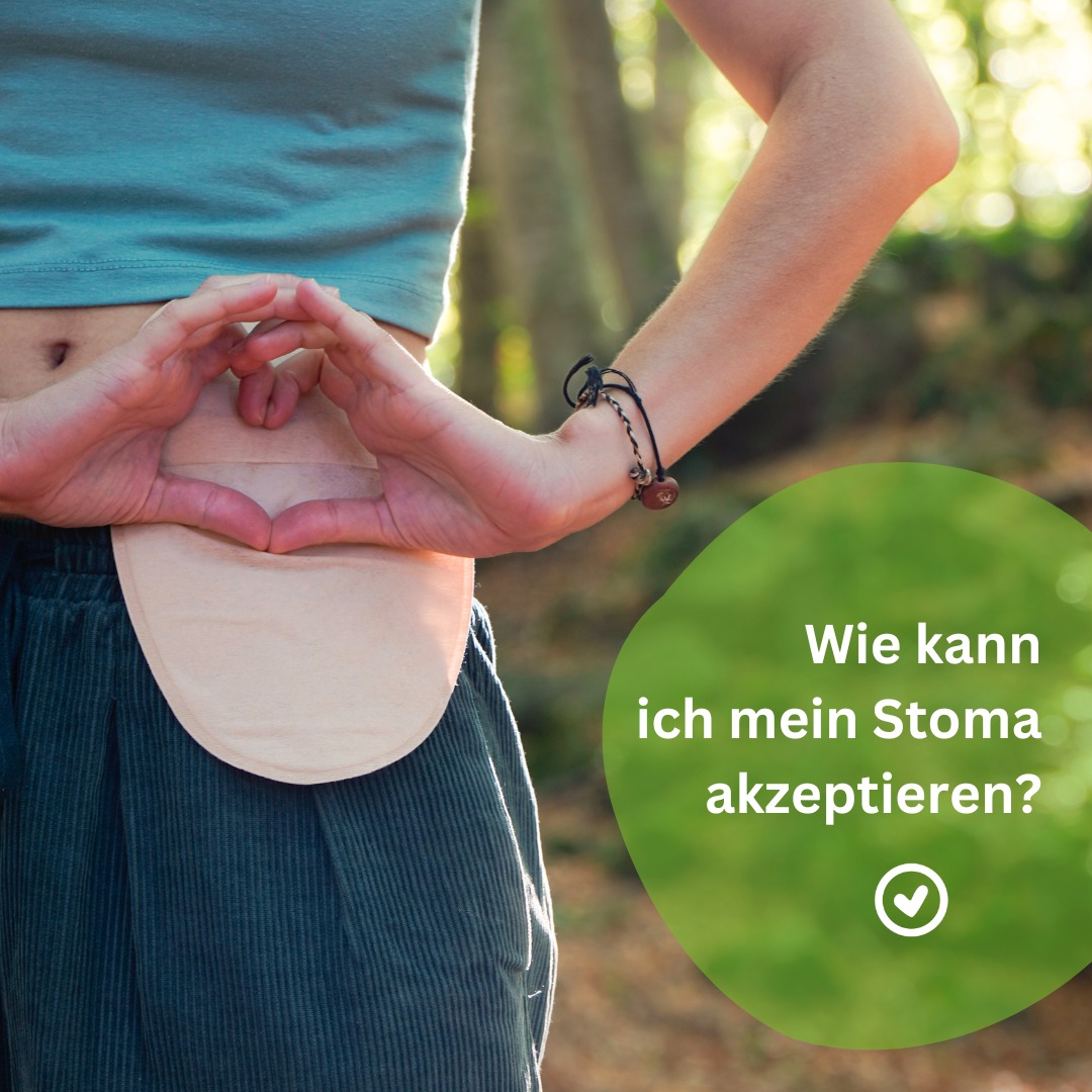 Akzeptanz des Stomas im Freien