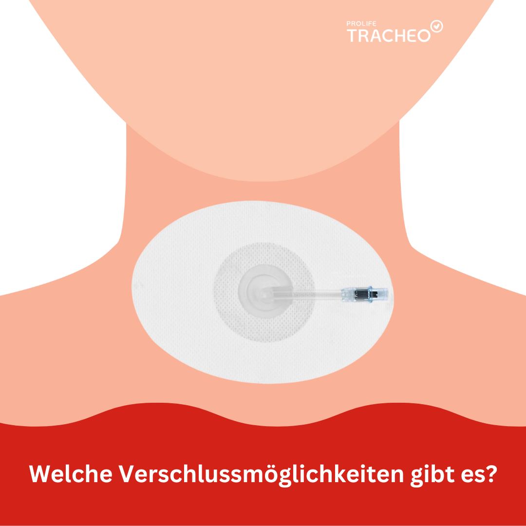 Welche Verschlussmöglichkeiten gibt es bei Tracheostomie?