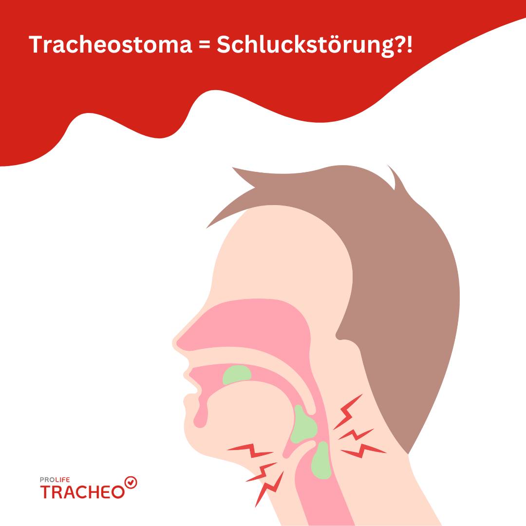Tracheostoma verursacht Schluckstörung? – Anatomie Illustration