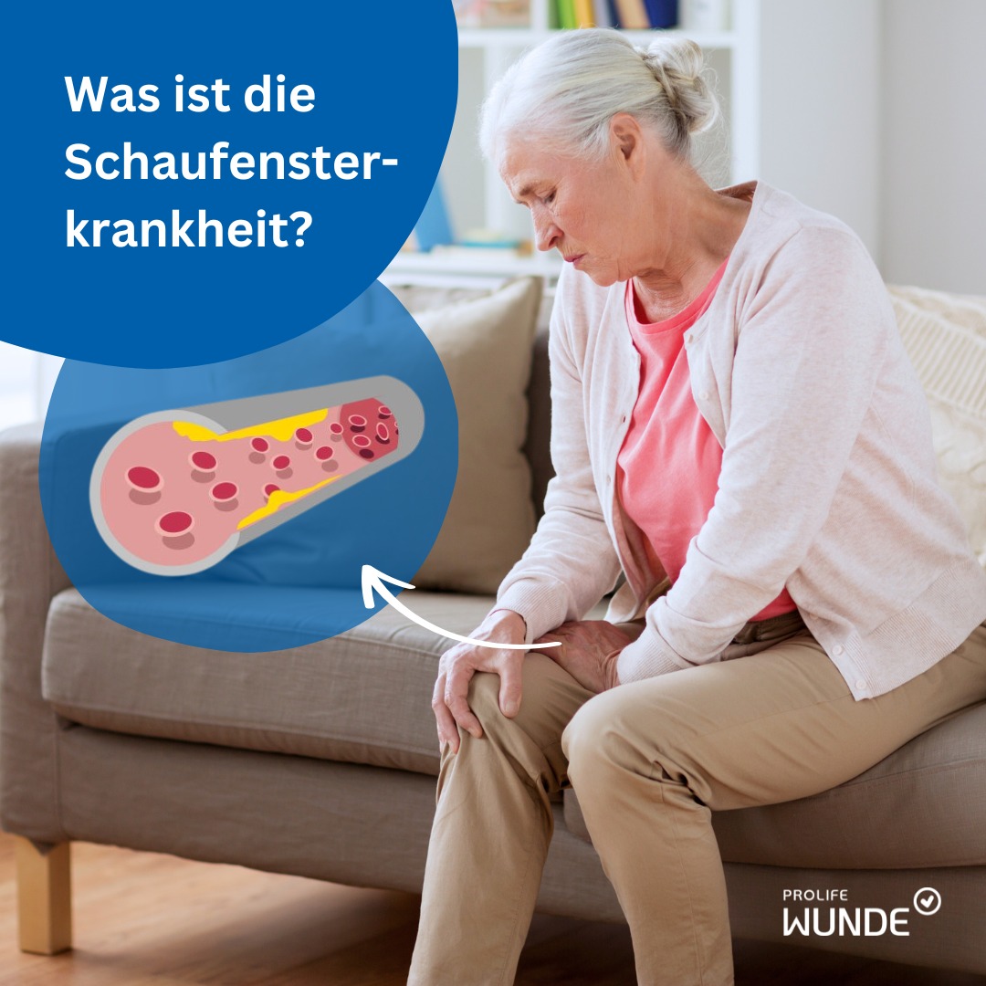Schaufensterkrankheit