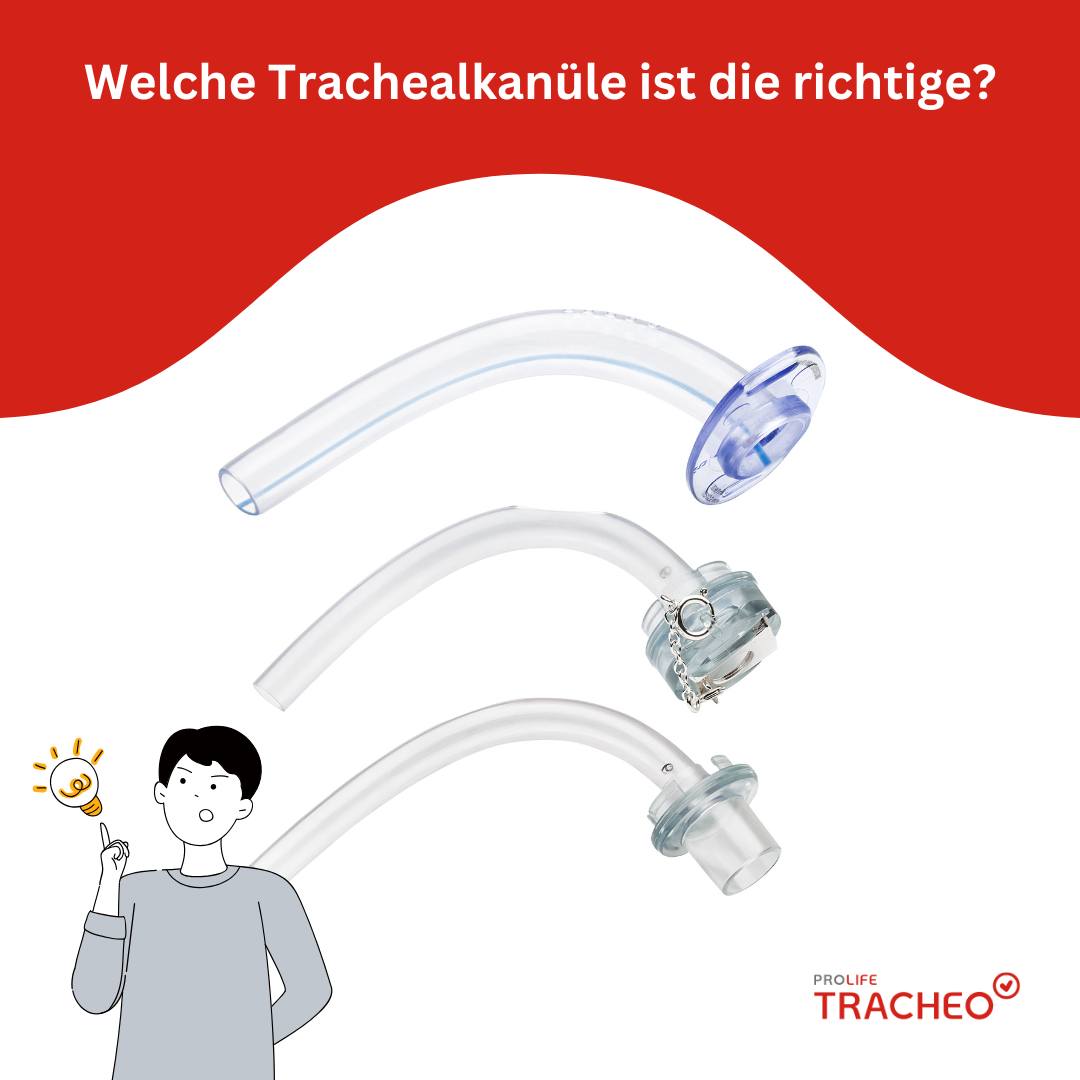 Trachealkanülenwahl