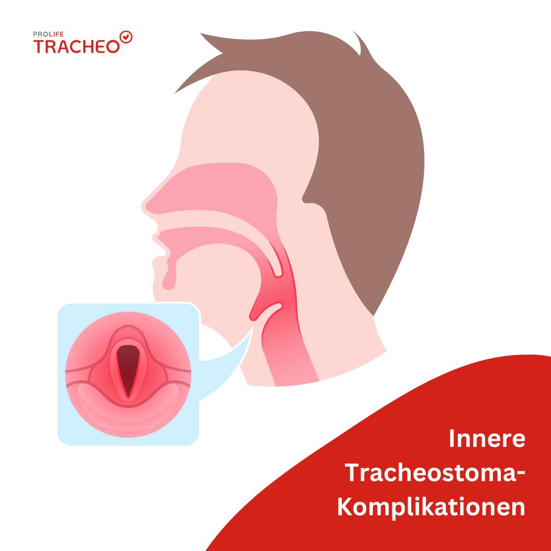 Innere Komplikationen