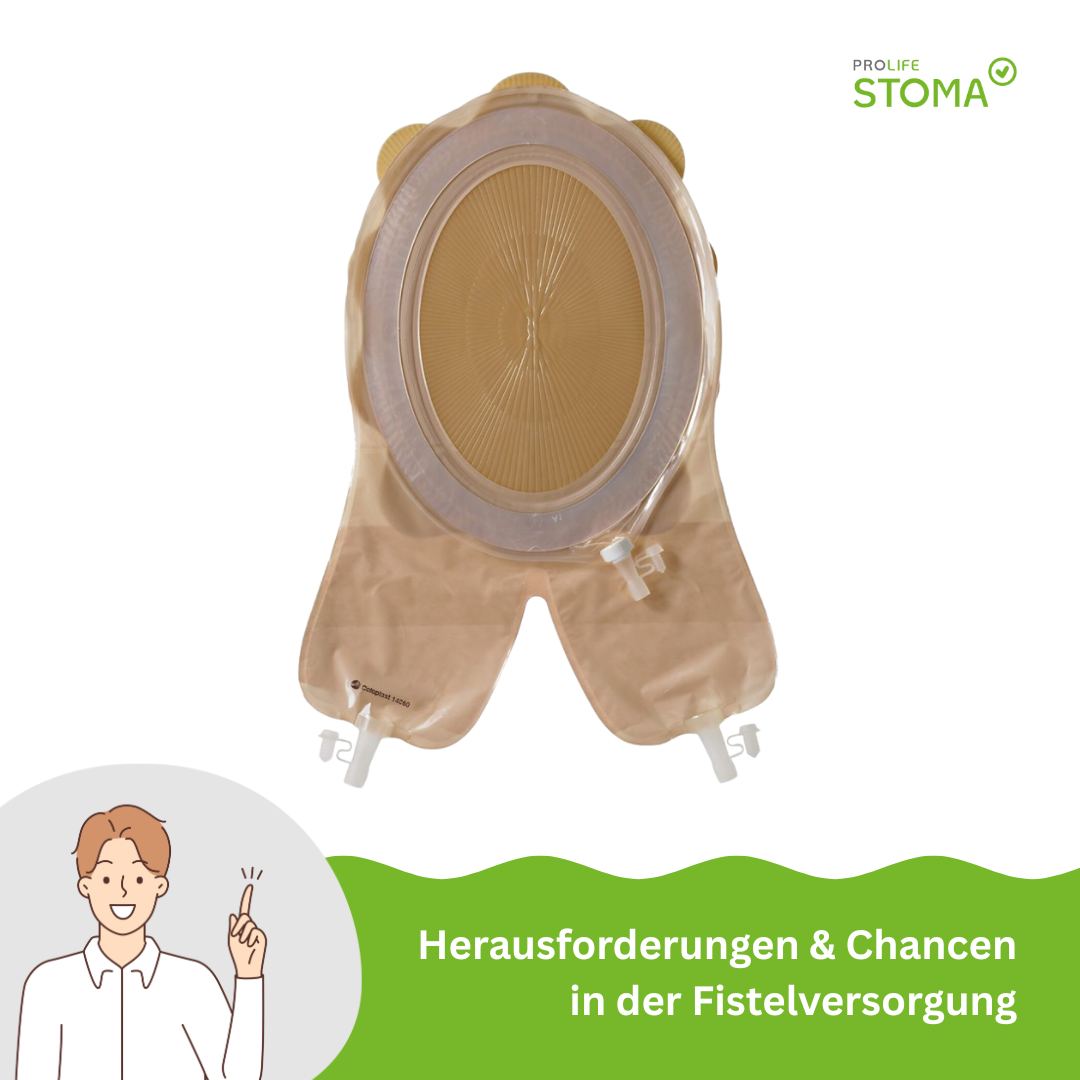 Fistelversorgung