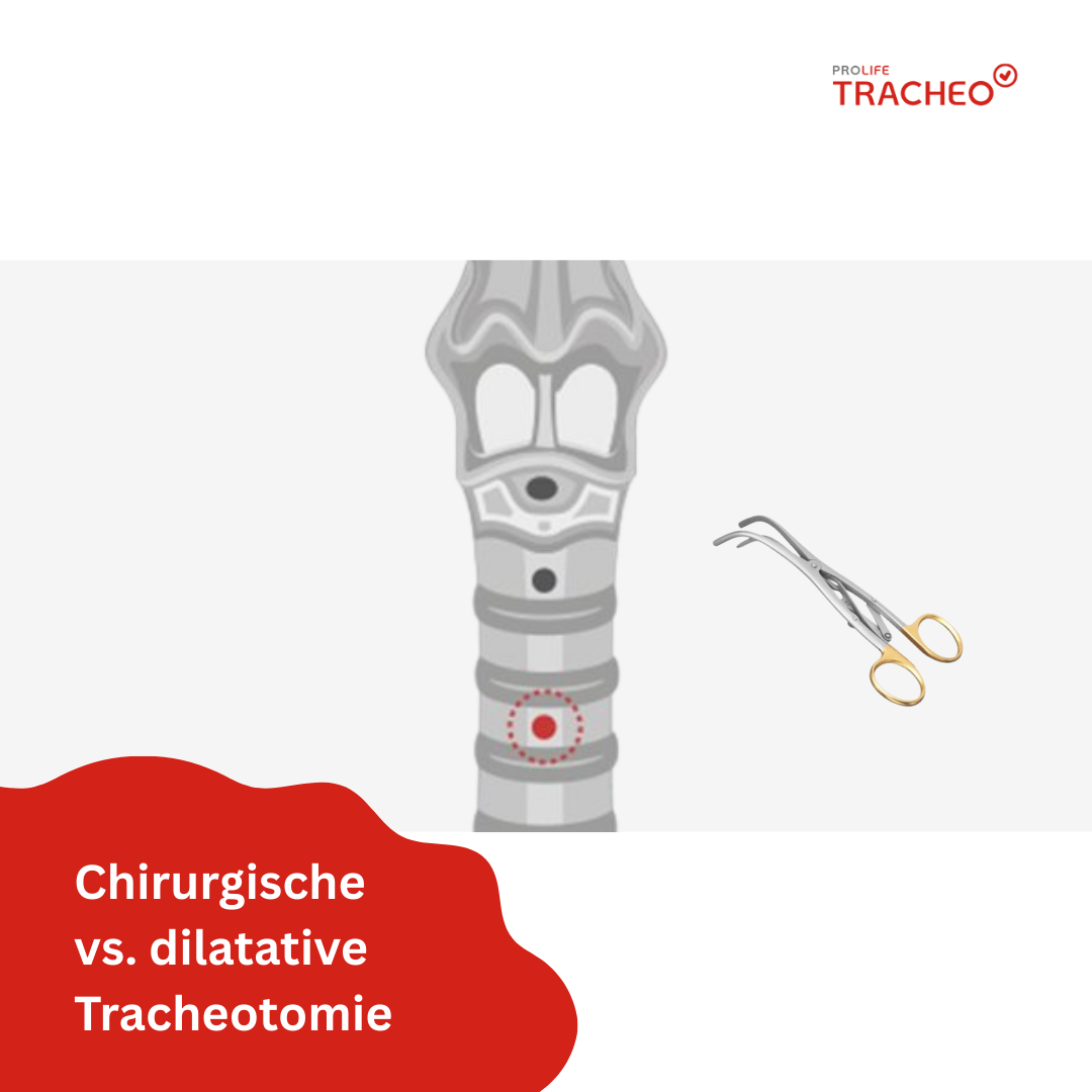 Arten der Tracheotomie