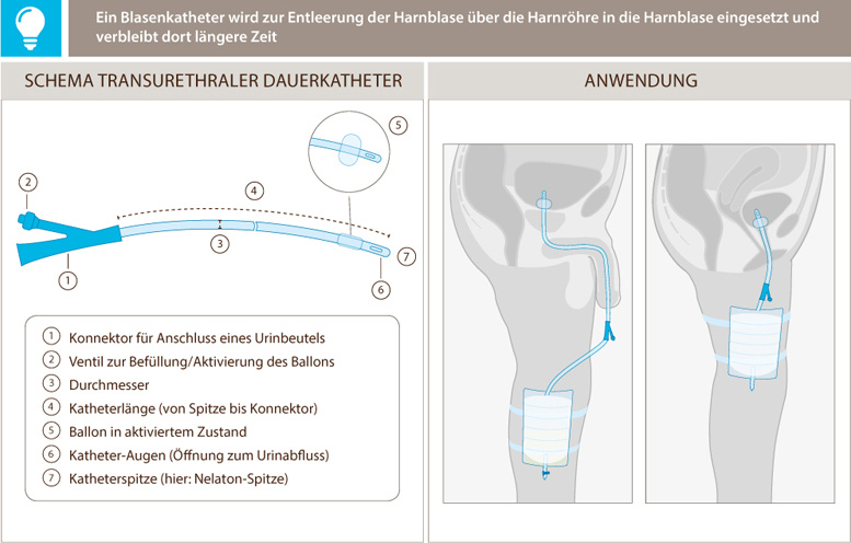 Zur Ansicht einer vergrößerten Darstellung auf die Skizze klicken. – © PROLIFE homecare GmbH 