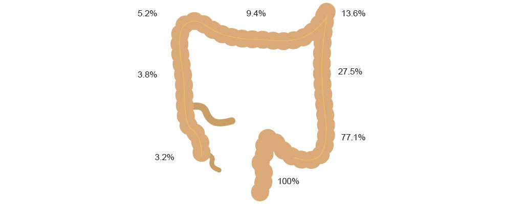 Häufigkeit von Morbus Hirschsprung in den einzelnen Darmabschnitten – Quelle: Kinderchirurgie Jena