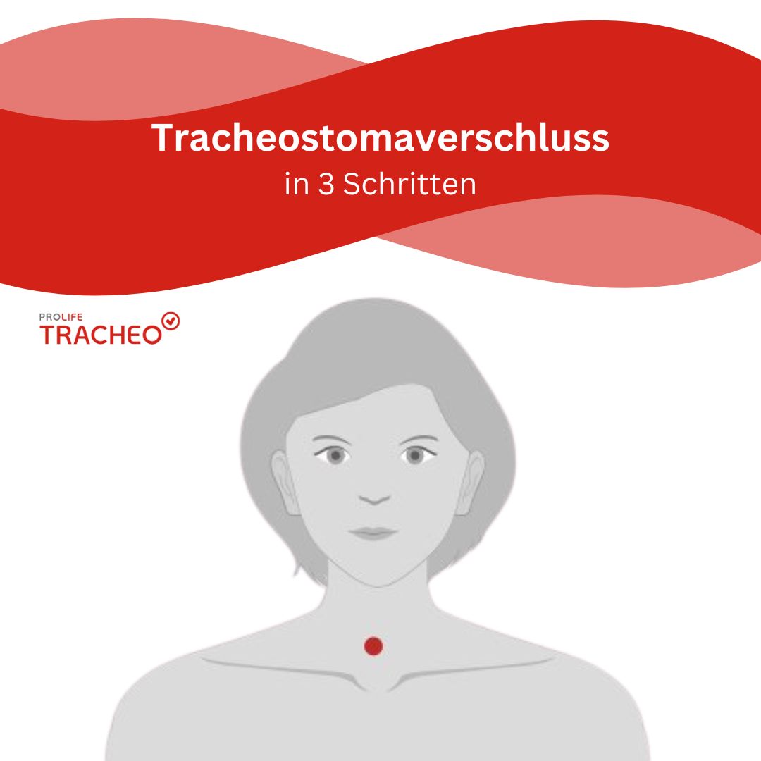 Tracheostomaverschluss Anleitung in 3 Schritten